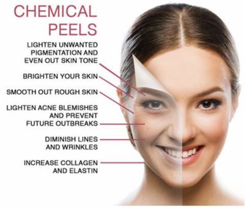 Chemical Peel Before and After | Face Peel Benefits | IMAGO Aesthetic Clinic