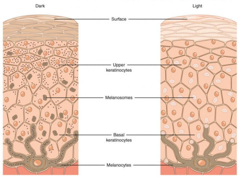 Pigmentation Removal by Laser Treatment Singapore