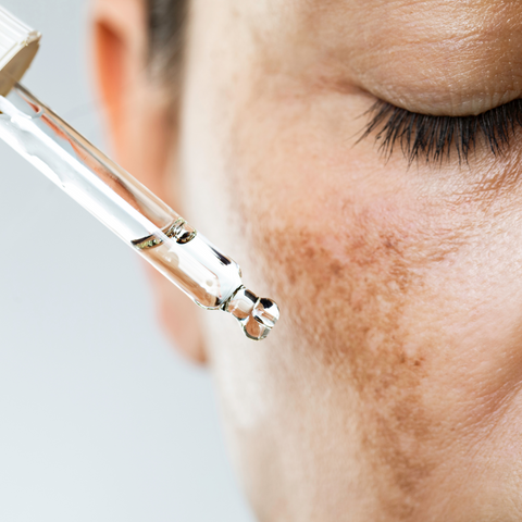 PIH Treatment: Topical retinoids include tretinoin, adapalene, and tazarotene.