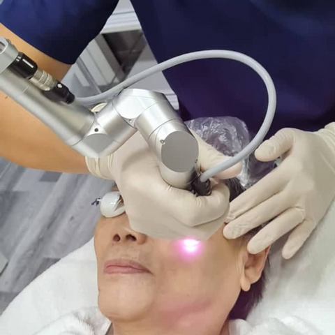 Close-up of a person receiving an active acne treatment with a blue light therapy device.