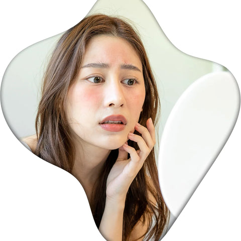 Acne Scar | Medical Aesthetics Laser Clinic Singapore