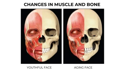Smile Lines | Changes in Muscle and Bone 