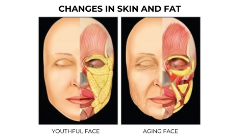 Smile Lines | Changes in Skin and Fat 