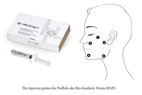 Profhilo 5 point BAP Injection Points | Medical Aesthetic Clinic